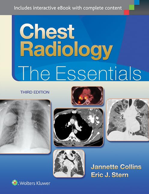 Chest Radiology the Essentials 3ED (HB 2015) (Essentials Series)