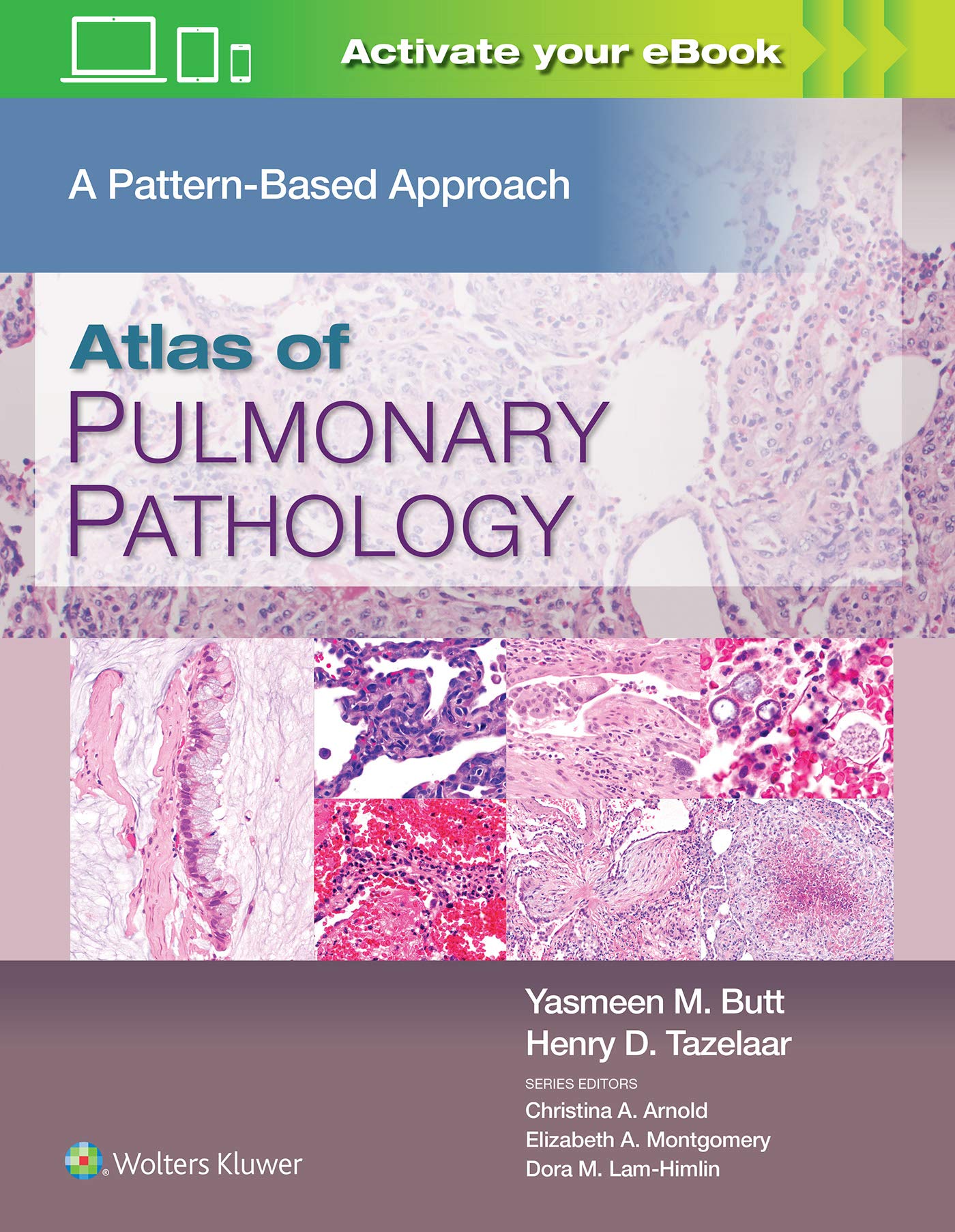 Atlas of Pulmonary Pathology a Pattern Based Approach