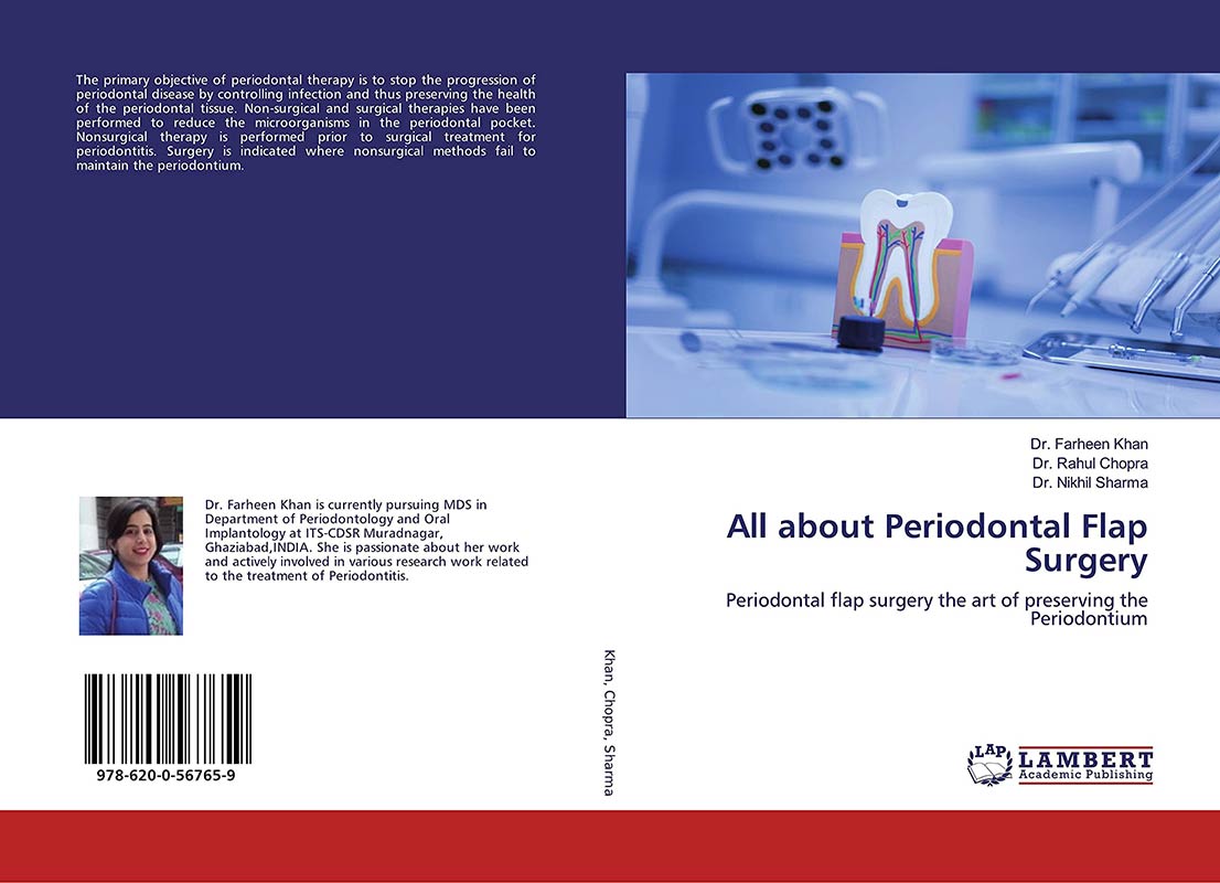 All about Periodontal Flap Surgery