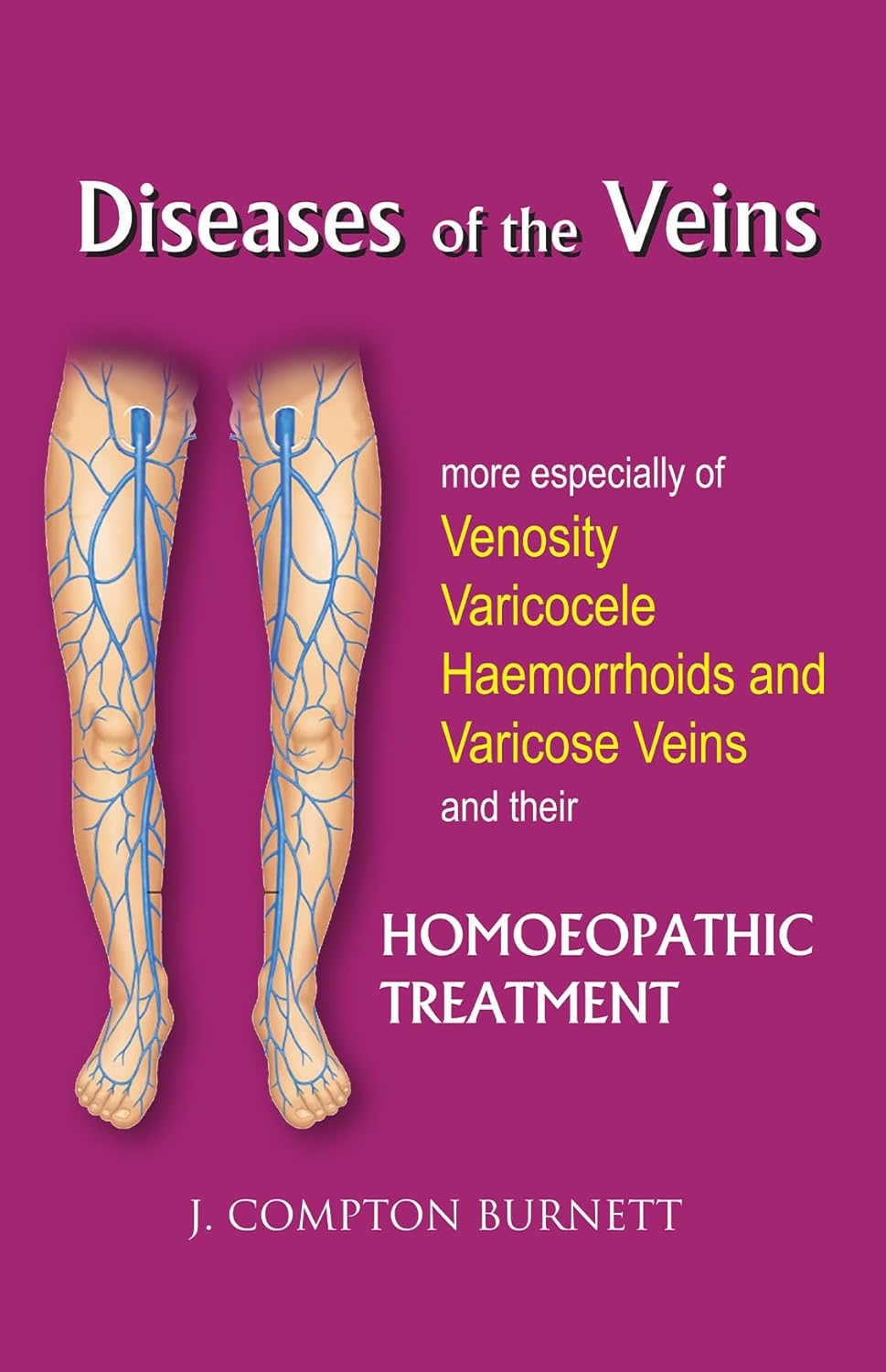 Diseases of the Veins