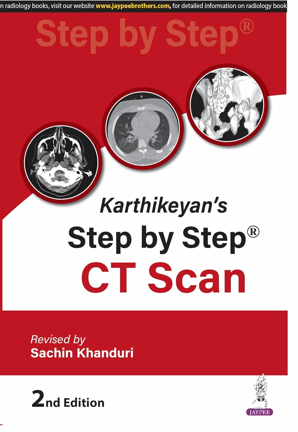 Karthikeyan's Step by Step CT Scan, 2nd Edition