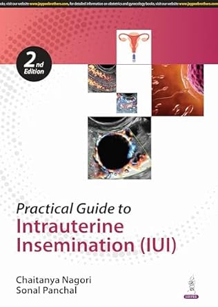 Practical Guide to Intrauterine Insemination (IUI)