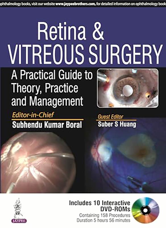 Retina & Vitreous Surgery—A Practical Guide to Theory, Practice and Management (Includes Interactive DVD-ROMs)