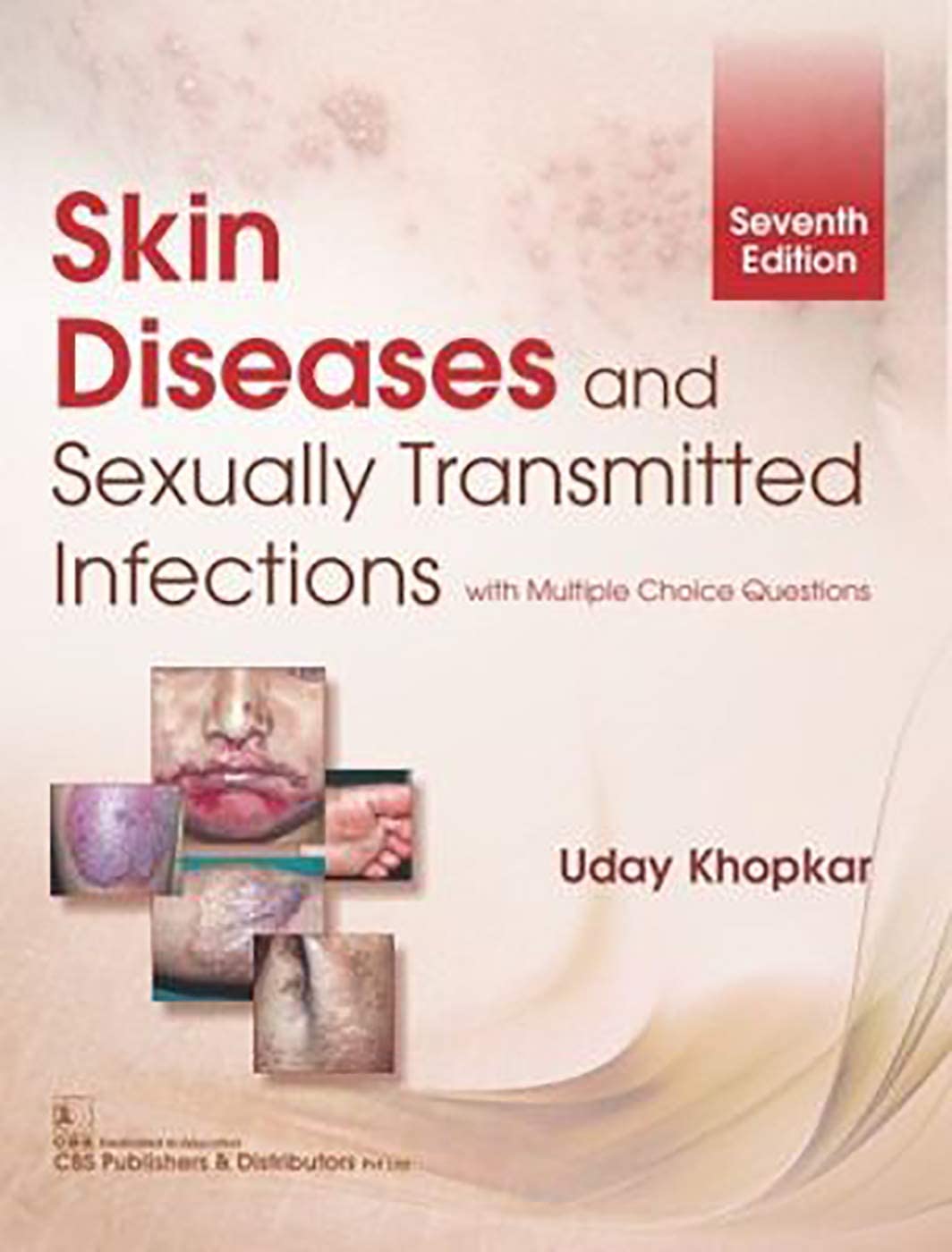 SKIN DISEASES AND SEXUALLY TRANSMITTED INFECTIONS 7ED (PB 2023)